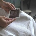 Srbija i reproduktivno zdravlje: Rak ne mora da bude prepreka za roditeljstvo