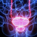 Rak prostate: Koji su simptomi i kako se leči