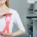 Oktobar - mesec borbe protiv raka dojke: Godišnje u Srbiji 1.646 žena izgubi bitku sa bolešću