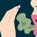 Kako pobediti neprijatan zadah u ustima