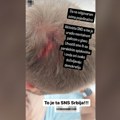 FOTO „Ovo je slika naprednjačke Srbije“: Aktivista SNS-a razbio mladiću glavu metalnom palicom