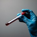 Veštačka krv iz laboratorije - pet metoda koje obećavaju