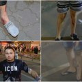 Povređeni građani u napadu SNS-ovaca: Jedan Vrbašanin ispečen po nogama, drugi pogođen ciglom