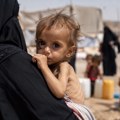 UNICEF upozorava: Više od 2,2 miliona dece mlađe od pet godina u Jemenu neuhranjeno