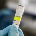 Ruski epidemiolog: Vakcina protiv hantavirusa moguća, ali registracija traje nekoliko godina