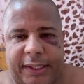 Čuveni brazilac brutalno pretučen! Bivši fudbaler izašao u provod sa udatom ženom, pa završio u modricama (video)