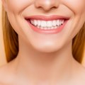 Letnji glow počinje brigom o izgledu: Hollywood smile najlepši modni detalj ovog leta!