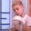Sećate li se Konstantina kojem je eksplodirala petarda u ruci Lekari su mu amputirali dva prsta, a evo čime se ovaj dečak…