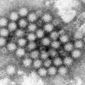 Porast slučajeva norovirusa u Britaniji, najveća opasnost dehidracija organizma