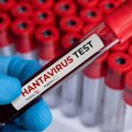 Virusolog upozorava na mogućnost pojave novih, opasnijih varijanti hantavirusa