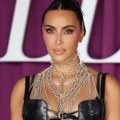 Skener pokazao da Kim Kardašijan ima „rupe“ u mozgu, lekari skeptični