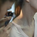 U Domu zdravlja „Voždovac“ preventivni pregledi kože