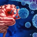 Testosteron može da spasi život muškarcima sa glioblastomom, smrtonosnim rakom mozga