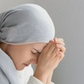 "Gubitak kose ne određuje ko sam": Žene obolele od raka pokazale svoju snagu