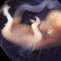 Naučnici stvorili ljudski embrion - bez spermatozoida i jajnih ćelija