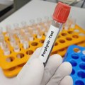 Hepatične porfirije: Retka bolest sa simptomima koje mnogi zanemaruju