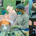(Foto, video) „dnevnik” u operacionoj sali Klinike za abdominalnu hirurgiju ukcv Godišnje urade oko 400 operacija žučne…