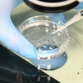 Семена течност донора са геном који изазива рак употребљена за зачеће скоро 200 деце, ББЦ: Коришћена и у Србији
