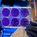 Stop za superbakterije: Studija Univerziteta Priston otkriva da broj preminulih može da se smanji za 18 odsto