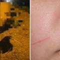 Turistkinja povređena na hrvatskom ostrvu posle jezivog incidenta: Upala u bolesnu zamku na putu