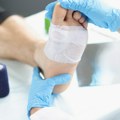 Откривен разлог зашто ране тешко зарастају код оболелих од дијабетеса: имуне ћелије саботирају процес