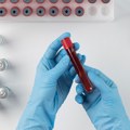 Novi test krvi prepoznaje više od 50 vrsta karcinoma – otkriva i one bez skrininga
