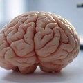 Rusija pravi test za rano otkrivanje sarkopenije: Prototip stiže već 2028. godine