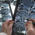 Procurila prepiska u kojoj vodeći kanadski naučnik tvrdi da mu je zabranjeno da istražuje misterioznu bolest mozga