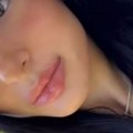"Otpili smo ih, moja je greška bila..." Nina Đogani morala na estetski zahvat, vidite kako sada izgleda