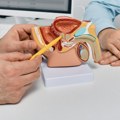 U Srbiji godišnje oko 1.000 muškaraca umre od raka prostate