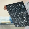 Hipertenzija – tiha opasnost koja se može kontrolisati