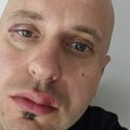 Brutalno pretučen gradonačelnik Ribnice