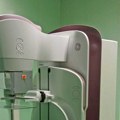 Od početka rada novog digitalnog mamografa urađeno 150 mamografija