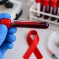 Upozorenje stručnjaka: Svet ponovo suočen sa rizikom širenja HIV-a