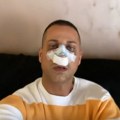 (Foto) pola lica mu u zavojima: Marko Đedović pokazao kako izgleda nakon operacije: "Trpeo sam gušenja"