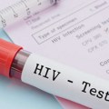 U Srbiji se 3.000 ljudi leči od HIV-a: Strah i stigma i dalje udaljavaju ljude od testiranja