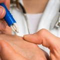 Не вадите крпеље сами: Педијатар указује на највеће грешке родитеља ВИДЕО