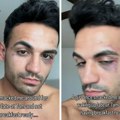 Žalio se da ga je "devojka" udarila jer joj nije spremio doručak: Ljudi skočili da ga brane, a onda je pokazao kako ona…