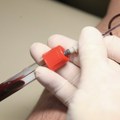 Na Fidžiju zabeležena najbrže rastuća epidemija HIV-a na svetu