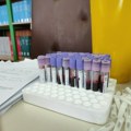 Batut: 127 slučajeva hantavirusa u Srbiji za deset godina