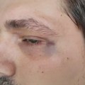 Ujedinjeni za Kosjerić: Napadač na snimatelja N1 sada udario i opozicionog aktivistu, drugi napad SNS funkcionera za dve…