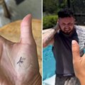 "Nalepila" komarca na dlan pa nasamarila muža: "Evo šta da radite kada vas iznervira"