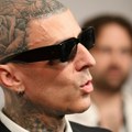 "70 odsto mog tela bilo je opečeno, imao sam 30 operacija": Poznati muzičar otvoreno o najtežem periodu života