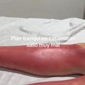 Devojka uživala na katamaranu, nije ni slutila kakvu je kobnu grešku učinila: Kad je shvatila, već je bila u bolnici (video)…