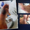 Uhapšen doktor i kozmetičarka ordinacije iz Beograda: Pogrešno lečio stopalo kod pacijenta