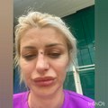 Oglasila se manekenka koju je dečko trudnu pretukao: Ovo je za nju važan dan