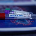 Pojavila se nova varijanta COVID-a: "Grlo poput brijača"