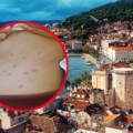 Majka papreno platila Apartman, a dete joj se probudilo sa ujedima "Ima 30 uboda po telu! Mislili smo da su komarci, ali su u…