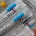 Za sedam dana u Srbiji oko 4.700 pozitivnih na korona virus