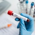 Odobrena vakcina za zaštitu od HIV-a: "Ovo menja pravila igre"
